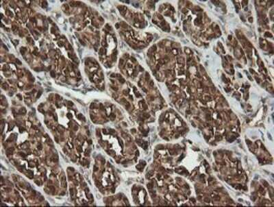 Immunohistochemistry-Paraffin: PGD Antibody (OTI2A5) [NBP2-45880]