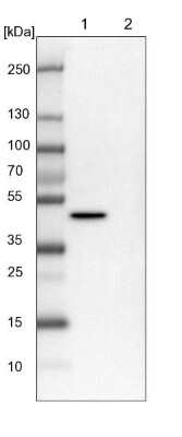 Western Blot: PGD Antibody [NBP1-85925]