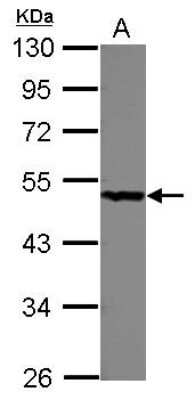 Western Blot: PGD Antibody [NBP2-19783]