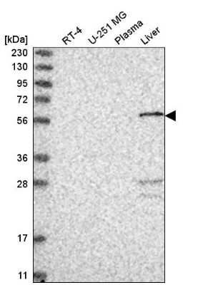 Western Blot: PGD Antibody [NBP2-58686]