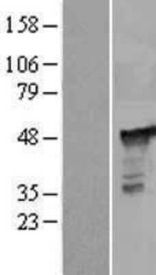 Western Blot: PGD Overexpression Lysate [NBL1-14329]