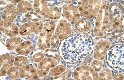 Immunohistochemistry-Paraffin: PGD2 Synthase/PTGDS Antibody [NBP1-79280]