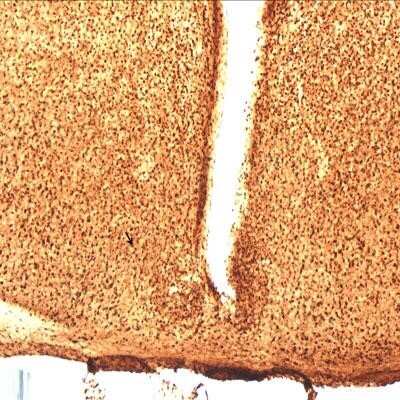 Immunohistochemistry-Paraffin: PGD2 Synthase/PTGDS Antibody [NBP1-79280]