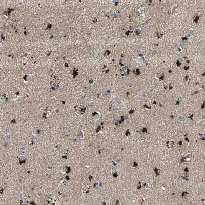 Immunohistochemistry-Paraffin: PGD2 Synthase/PTGDS Antibody [NBP1-81291]