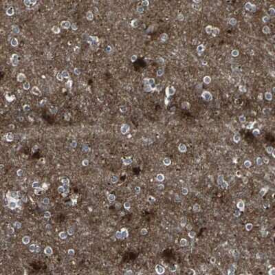 Immunohistochemistry-Paraffin: PGD2 Synthase/PTGDS Antibody [NBP1-81291]