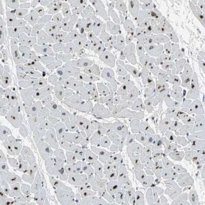 Immunohistochemistry-Paraffin: PGD2 Synthase/PTGDS Antibody [NBP1-81291]