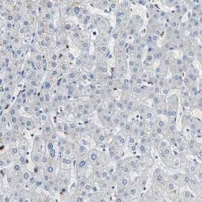 Immunohistochemistry-Paraffin: PGD2 Synthase/PTGDS Antibody [NBP1-81291]