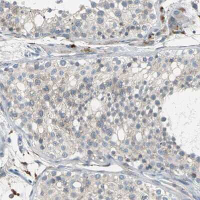 Immunohistochemistry-Paraffin: PGD2 Synthase/PTGDS Antibody [NBP1-81291]