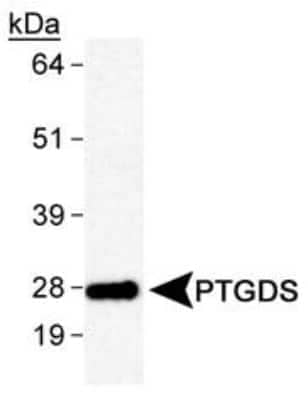 Western Blot: PGD2 Synthase/PTGDS AntibodyBSA Free [NB110-59909]