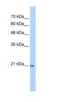 Western Blot: PGD2 Synthase/PTGDS Antibody [NBP1-79280]