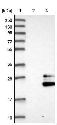Western Blot: PGD2 Synthase/PTGDS Antibody [NBP1-81291]