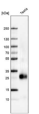 Western Blot: PGD2 Synthase/PTGDS Antibody [NBP1-81291]