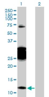 Western Blot: PGEA1 Antibody [H00025776-D01P]