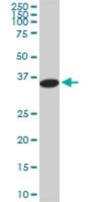 Western Blot: PGGT1B Antibody (5E4) [H00005229-M02]