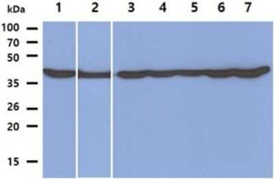 Western Blot: PGK1 Antibody (2F4)BSA Free [NBP2-59392]