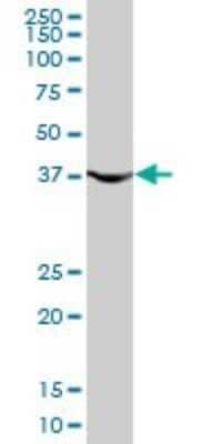 Western Blot: PGK1 Antibody (2H4) [H00005230-M02]