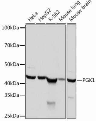 Western Blot: PGK1 Antibody (4B3Q3) [NBP3-15453]