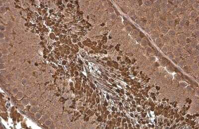 Immunohistochemistry-Paraffin: PGK1 Antibody (GT21612) [NBP3-13618]