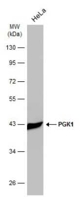 Western Blot: PGK1 Antibody (GT21612) [NBP3-13618]