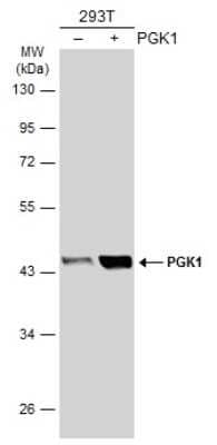 Western Blot: PGK1 Antibody (GT21612) [NBP3-13618]