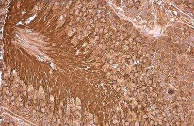 Immunohistochemistry-Paraffin: PGK1 Antibody [NBP1-33685]