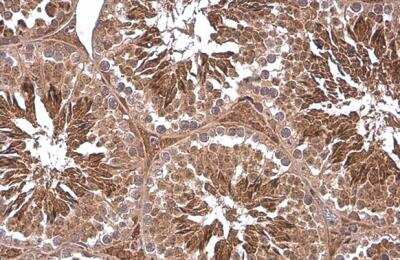 Immunohistochemistry-Paraffin: PGK1 Antibody [NBP1-33685]