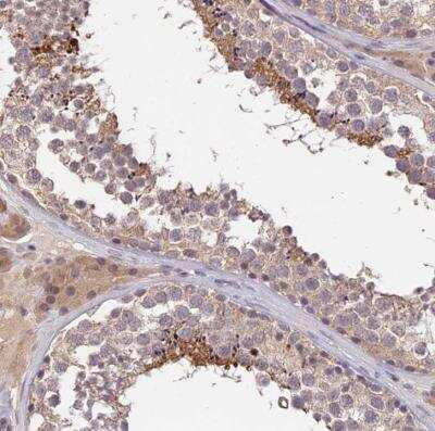 Immunohistochemistry-Paraffin: PGK1 Antibody [NBP2-54721]