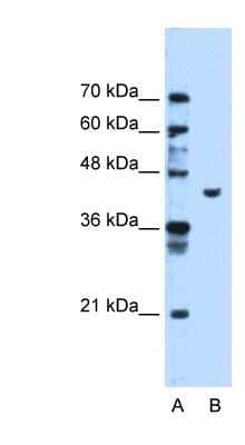 Western Blot: PGK1 Antibody [NBP1-55154]