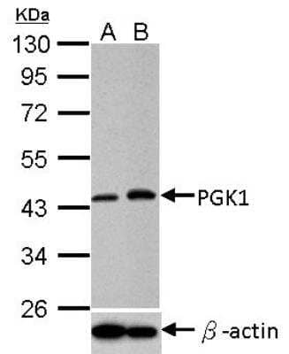 Western Blot: PGK1 Antibody [NBP2-19784]