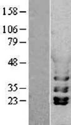 Western Blot: PGK1 Overexpression Lysate [NBP2-04157]