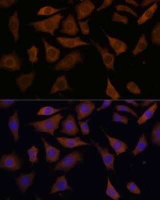 Immunocytochemistry/ Immunofluorescence: PGK2 Antibody - Azide and BSA Free [NBP2-94204]