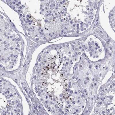 Immunohistochemistry: PGK2 Antibody [NBP2-68960]