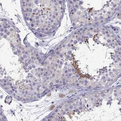 Immunohistochemistry: PGK2 Antibody [NBP2-68964]