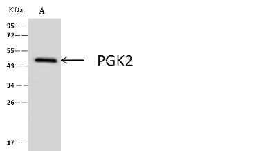Immunoprecipitation: PGK2 Antibody [NBP2-99497]