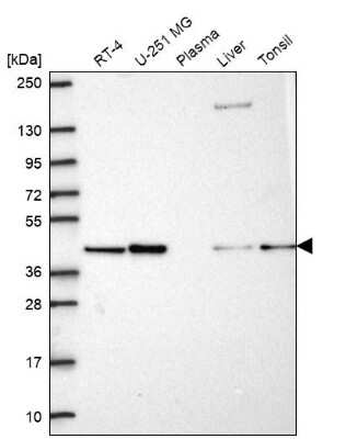 Western Blot: PGK2 Antibody [NBP2-68960]