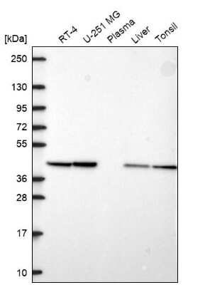 Western Blot: PGK2 Antibody [NBP2-68964]