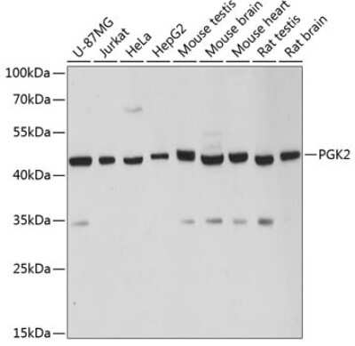 Western Blot: PGK2 AntibodyAzide and BSA Free [NBP2-94204]