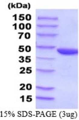 SDS-PAGE: Recombinant Human PGK2 His Protein [NBP2-52287]