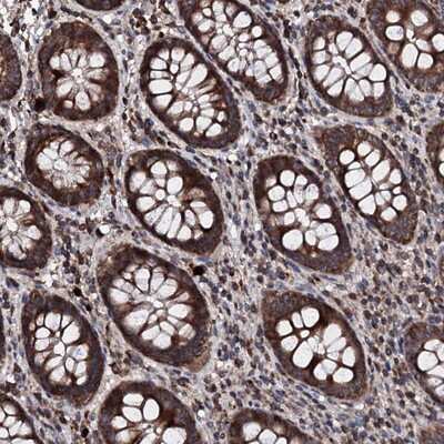 Immunohistochemistry-Paraffin: PGL2 Antibody [NBP1-92259]