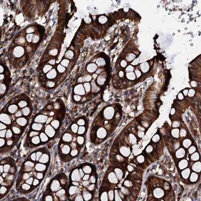 Immunohistochemistry-Paraffin: PGL2 Antibody [NBP1-92260]