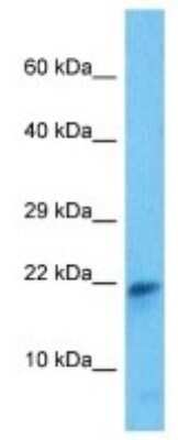 Western Blot: PGL2 Antibody [NBP3-10124]