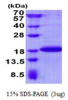 SDS-PAGE: Recombinant Human PGL2 His Protein [NBP2-22834]