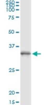 Immunoprecipitation: PGLS Antibody (2D9) [H00025796-M01]