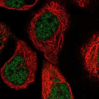 Immunocytochemistry/ Immunofluorescence: PGLS Antibody [NBP2-47333]