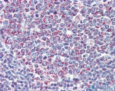Immunohistochemistry: PGLS Antibody [NBP1-56387]