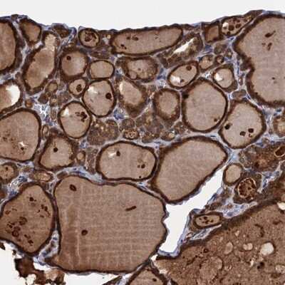 Immunohistochemistry: PGLS Antibody [NBP2-47333]