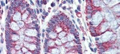 Immunohistochemistry-Paraffin: PGLS Antibody [NBP1-56387]