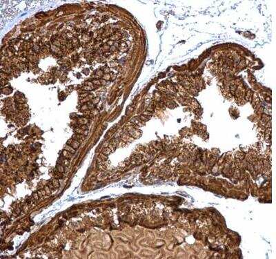 Immunohistochemistry-Paraffin: PGLS Antibody [NBP2-19785]