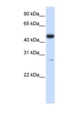 Western Blot: PGLS Antibody [NBP1-56387]