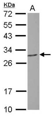 Western Blot: PGLS Antibody [NBP2-19785]